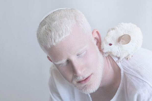 Гипнотизирующая и удивительная красота людей-альбиносов альбинос, красота, люди
