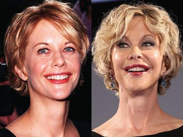 Знаменитости и их обновлённые лица