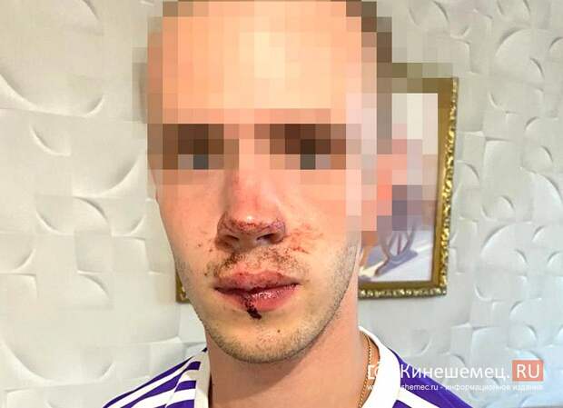 В Кинешме замдиректора ДК «Октябрь» жестоко избил 19-летнего студента у клуба В Кинешме замдиректора ДК «Октябрь» жестоко избил 19-летнего студента у клуба