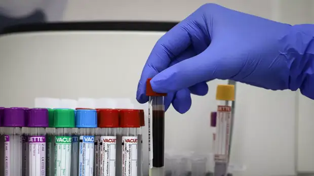 В России за сутки зафиксировано 6248 новых случаев коронавируса