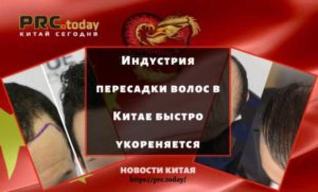 Индустрия пересадки волос в Китае быстро укореняется