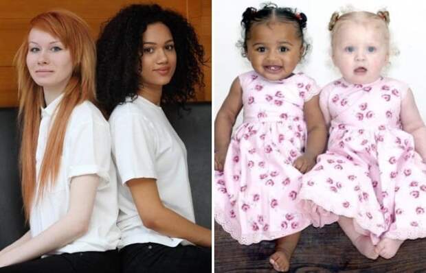 Как выглядят самые непохожие близнецы в мире: Братья и сестры с разным цветом кожи