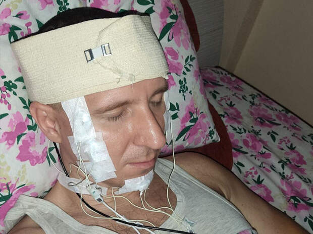 Исследователь Радуга рассказал, как просверлил себе череп для управления снами: “Приблизил будущее”
