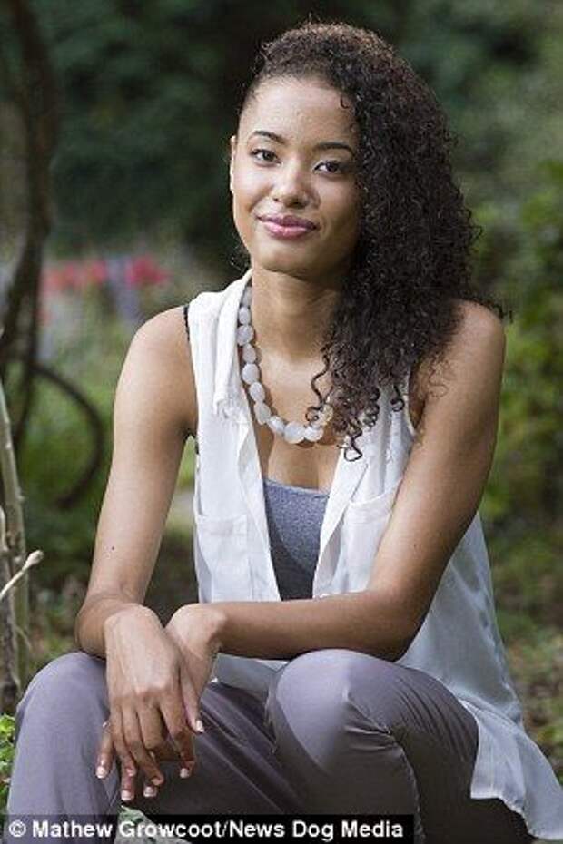 Айша Джонс, Ayesha Jones, девушка с кривой спиной стала моделью, страшный сколиоз