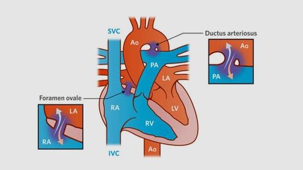 Организм новорожденных способен регенерировать часть повреждённого сердца  дети, младенец, факты