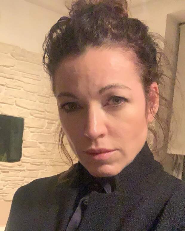 Пластически хирург рассказала, какие операции делала Алена Хмельницкая