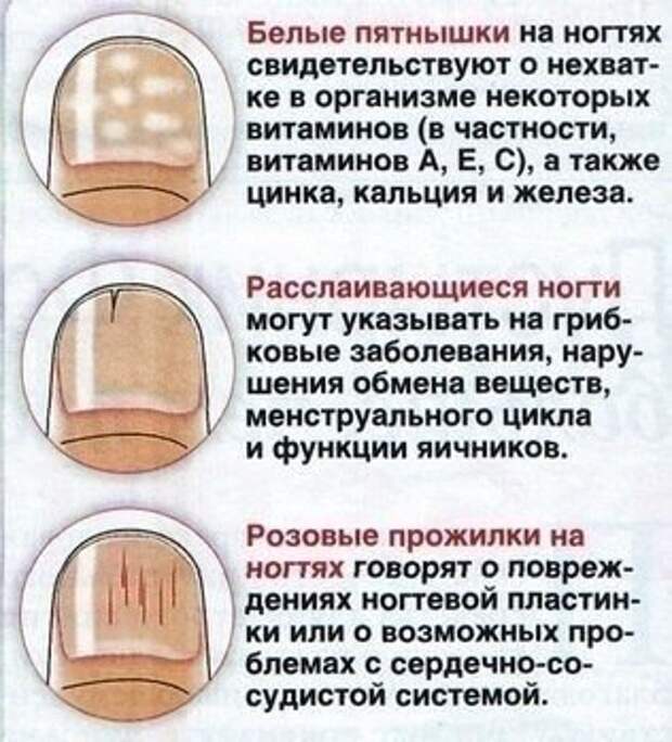 ногти