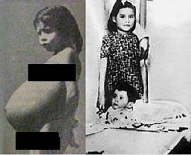 Самая молодая роженица Лина Медина