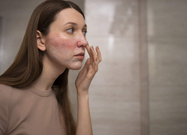 Кожа сигналит первой: какие болезни начинаются с внешних проявлений