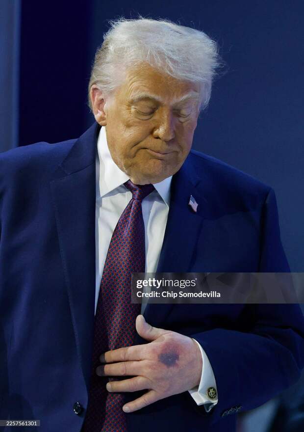 🤔Однажды в Давосе