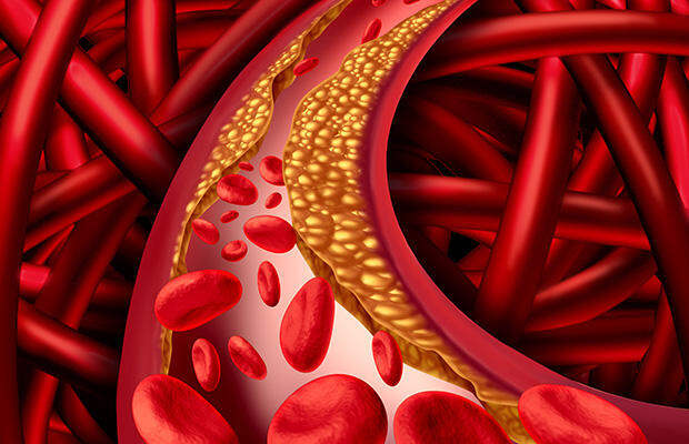 shutterstock_297965735-cholesterol-lightspring