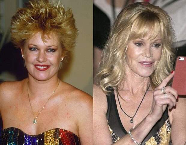 Знаменитости и их обновлённые лица