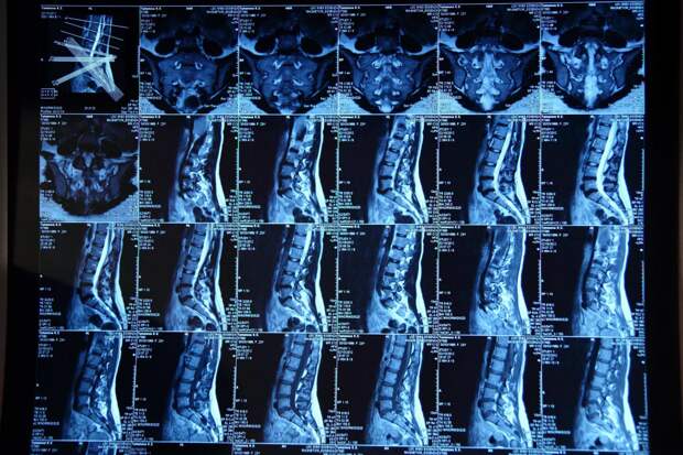 МРТ отделов позвоночника: какие бывают виды