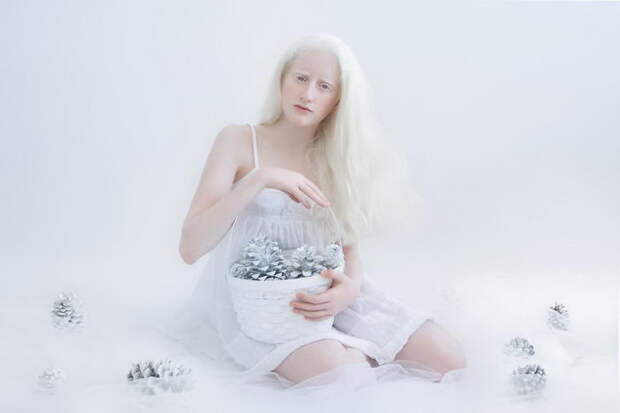 Красота альбиносов в фотографиях Yulia Taits Красота альбиносов в фотографиях Yulia Taits