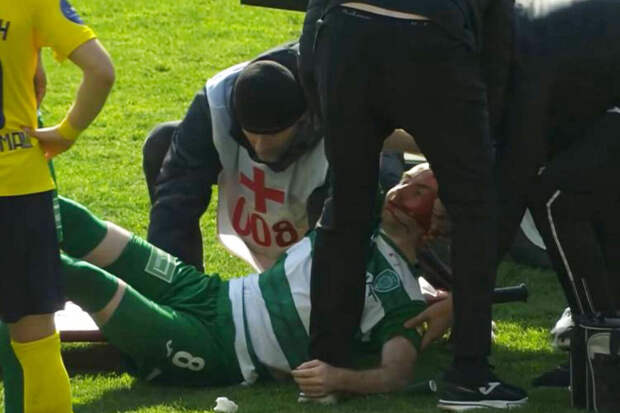 Представитель игрока "Ахмата" Богосаваца: все обошлось, сотрясения нет