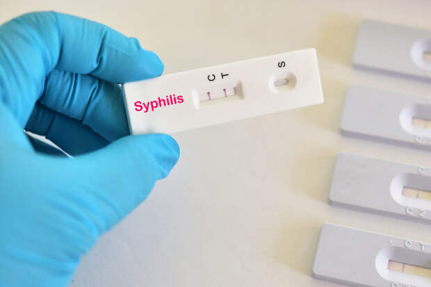 Врач Заславский: поздние стадии сифилиса стали встречаться чаще из-за COVID-19