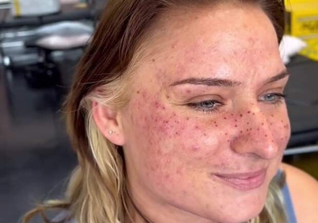 Сетевые тролли осмеяли тату-мастера, нарисовавшего звезды на лице клиентки