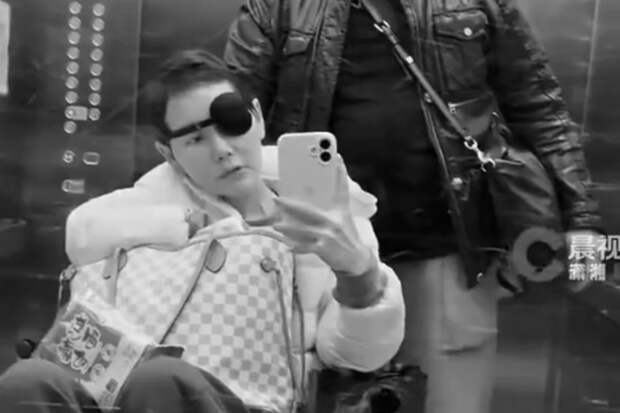 Ослепшую из-за рака блогершу не смогли спасти