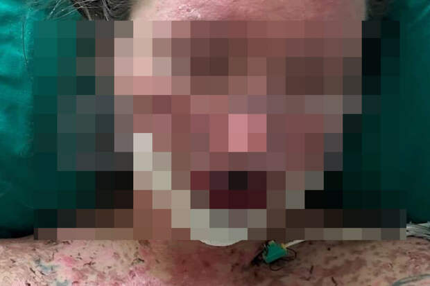 SHOT: в Москве женщина попала в реанимацию после приема лекарств