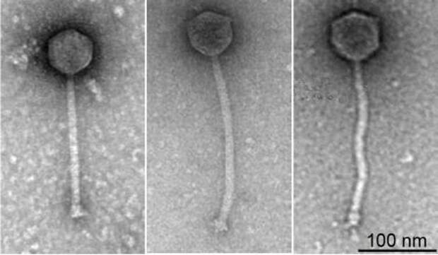 Человека впервые вылечили генетически модифицированными бактериофагами