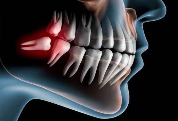 Импланты могут уйти в прошлое: учёные нашли способ вырастить новые коренные зубы