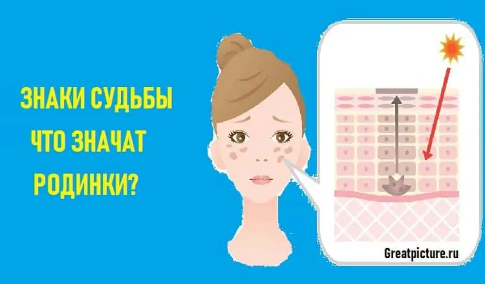 Что означают родинки. Значение родинок на теле. Что означают родинки на теле мужчины. Что означает родимоепетно. Знаки судьбы родинки на лице.