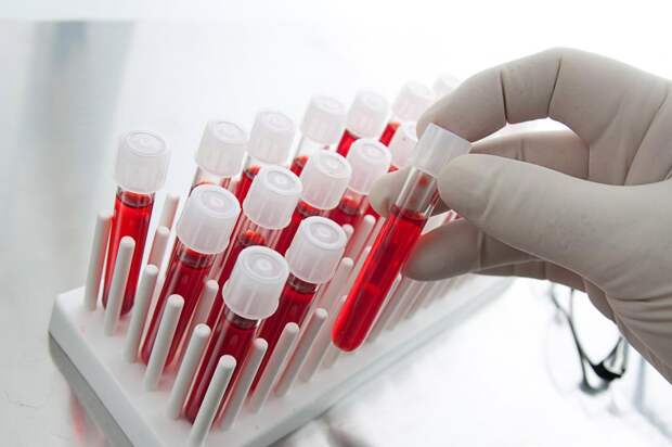 Какой анализ покажет онкологию? Признаки онкологии по анализу крови
