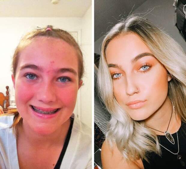 20 человек из флешмоба 10YearsChallenge которые удивили своими изменениями