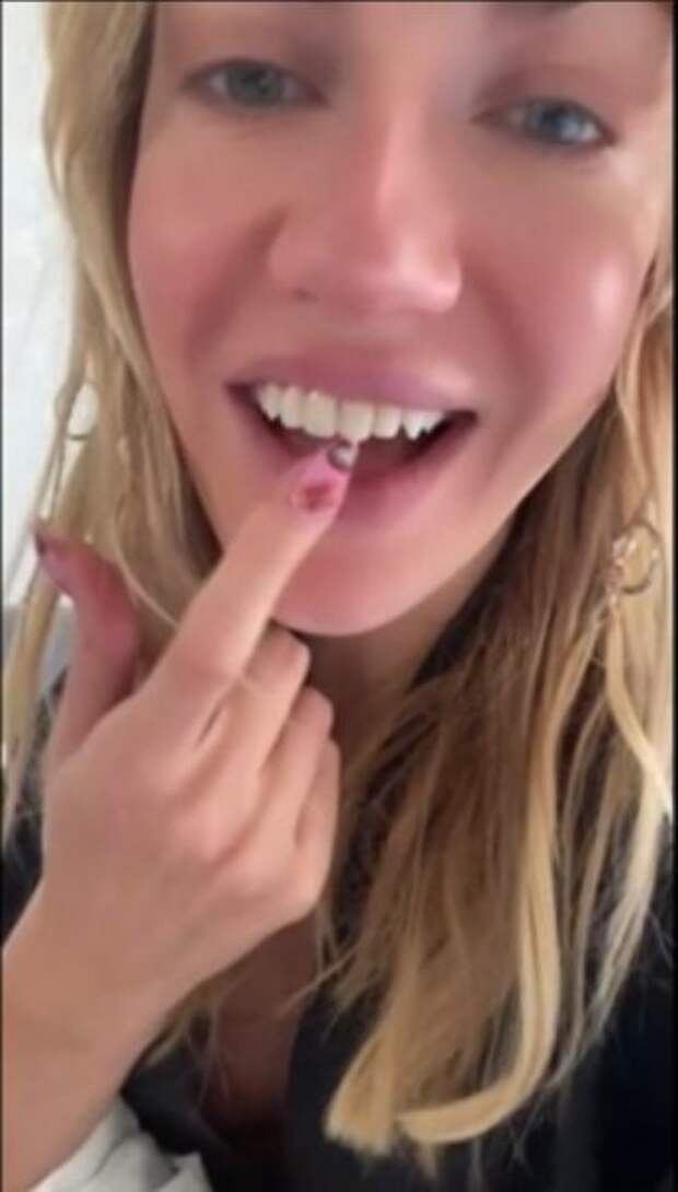 Леся Никитюк сломала зуб