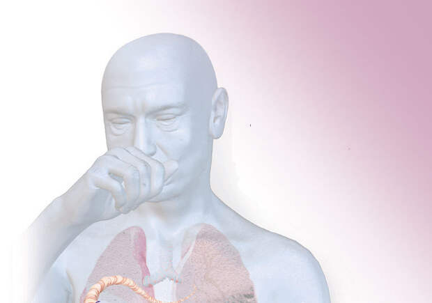 Что такое сердечный кашель