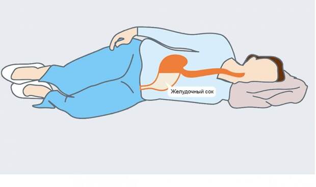 Здоровье вашего кишечника и общее состояние могут зависеть от позы во сне