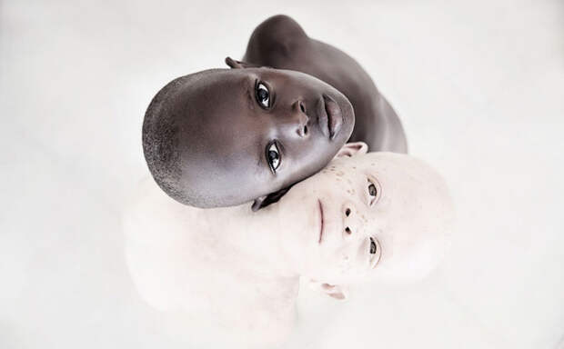 «Под одним солнцем»: Изумительная красота детей-альбиносов, за головы которых назначена награда