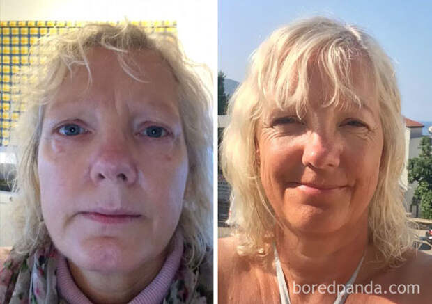 before-after-sobriety-photos-76