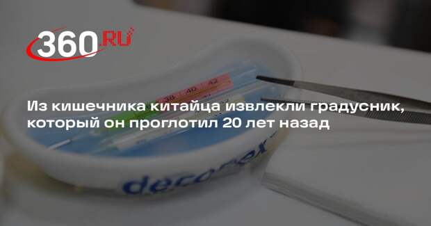 Из кишечника китайца извлекли градусник, который он проглотил 20 лет назад