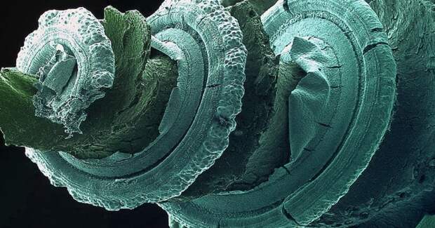 Эффект генной терапии врожденной глухоты сохранился спустя 2,5 года