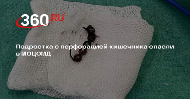 Подростка с перфорацией кишечника спасли в МОЦОМД