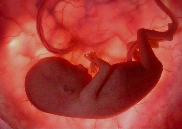 Картинки по запросу фото эмбриона