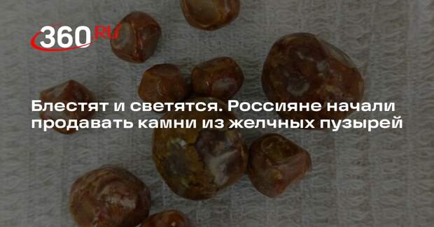 «Shot Проверка»: россияне начали выставлять на продажу камни из желчных пузырей