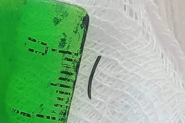 В Приморье мужчине в глаз во время работы с инструментом воткнулся кусок металла