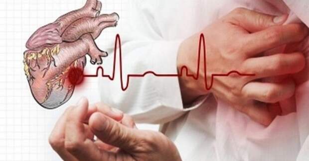 В случае сердечного приступа, у вас есть только 10 секунд, чтобы спасти свою жизнь!