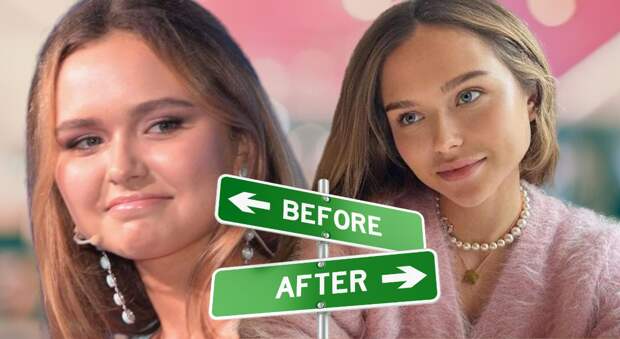 Стеша Маликова – Исчезновение лица: Пластика, погубившая «ангела»