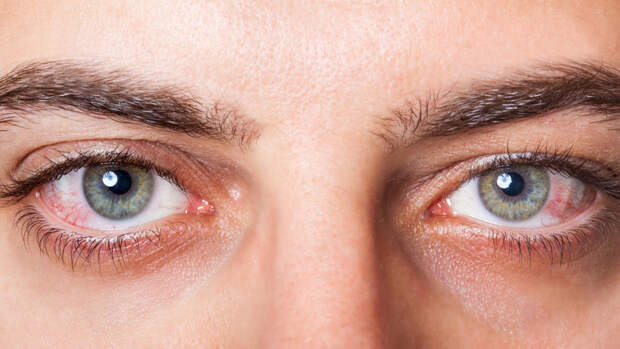 MedicalXpress: стресс усугубляет синдром сухого глаза
