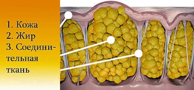 Целлюлит — великий всемирный обман. Эксперт разнёс в пух и прах бред, который женщинам впаривают рекламщики