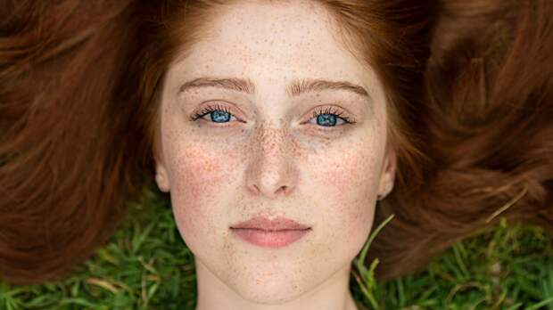 Игра в пятнашки: как предотвратить пигментные пятна, советы дерматолога