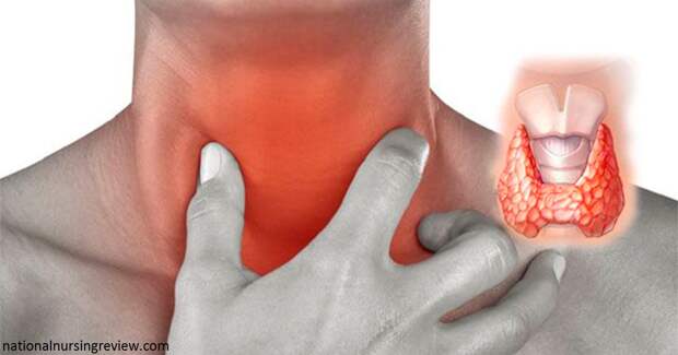 Щитовидку можно привести в ″норму″ за 8 дней с помощью семян кориандра