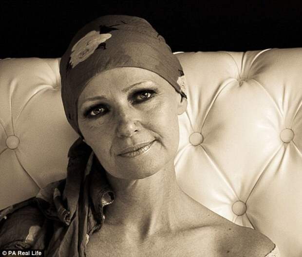 Восхитительная топлес-фотосессия женщины после двойной мастэктомии, которая отказалась от силиконовой груди  болезнь, фотосессия