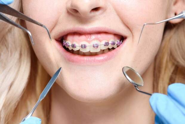 как ухаживать за зубами и полостью рта