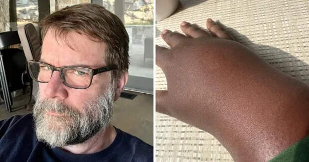 12 интересных случаев, когда с телом людей случилось что-то странное