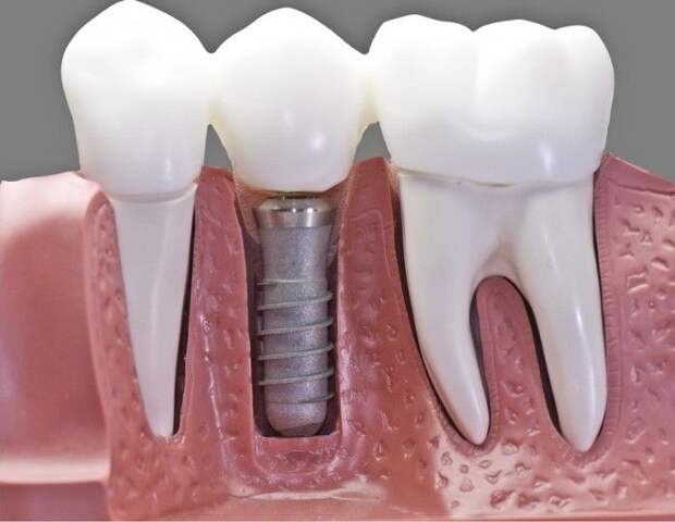 как ухаживать за зубами советы стоматолога