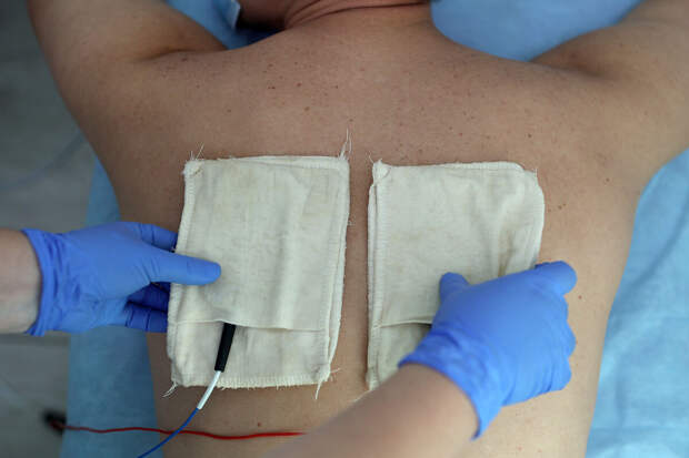 В Новосибирске мужчина получил ожог второй степени во время электрофореза